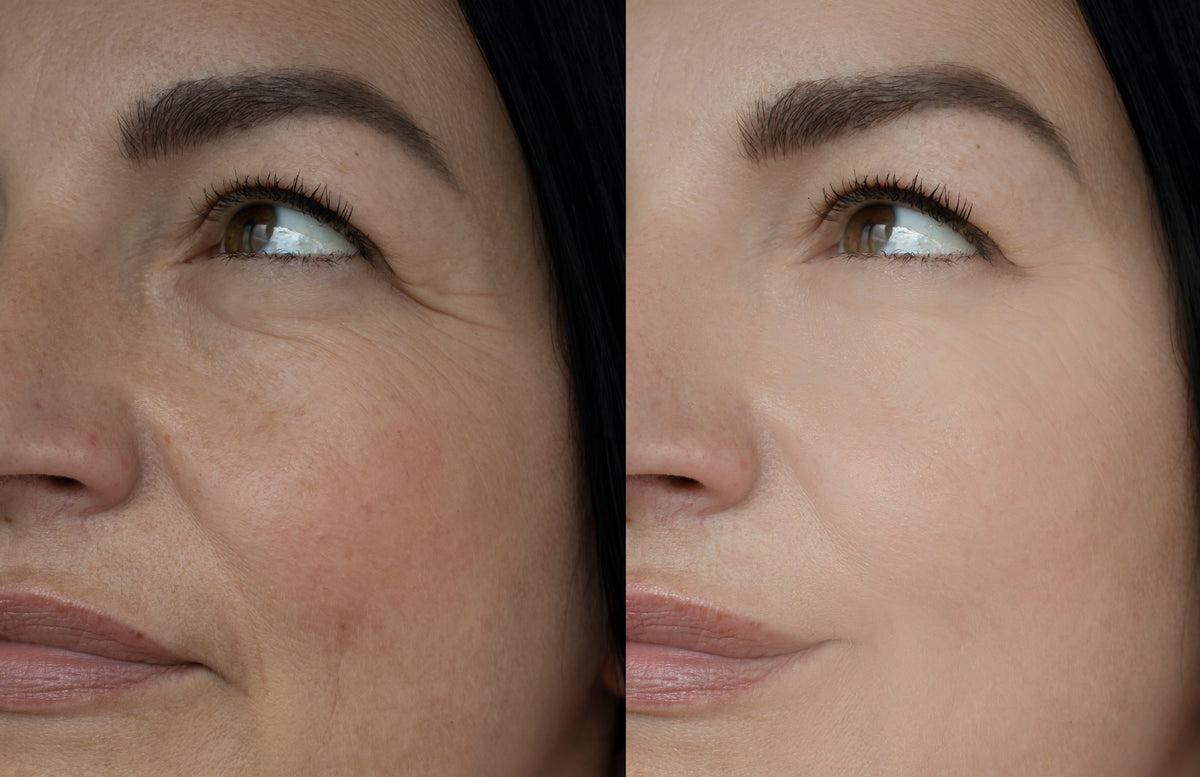Skin Blends